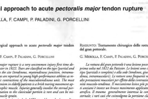 Surgical Approach to Acute Pectoralis Major Ruptures