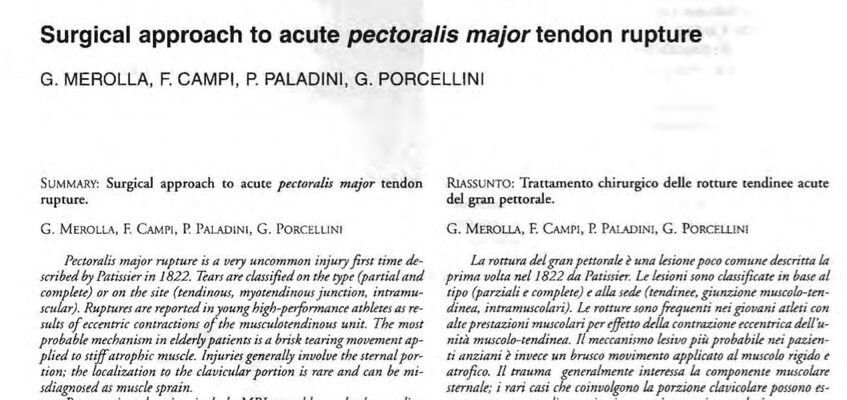 Surgical Approach to Acute Pectoralis Major Ruptures