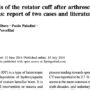 Ossifying tendinitis of the rotator cuff after arthroscopic excision of calcium deposit