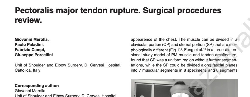 Pectoralis major tendo rupture surgical procedures review