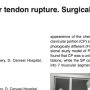 Pectoralis major tendo rupture surgical procedures review