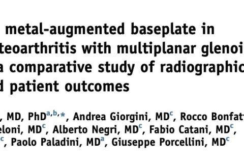 BIO-RSA vs. metal-augmented baseplate in shoulder osteoarthritis with multiplanar glenoid deformity: a comparative study of radiographic findings and patient outcomes
